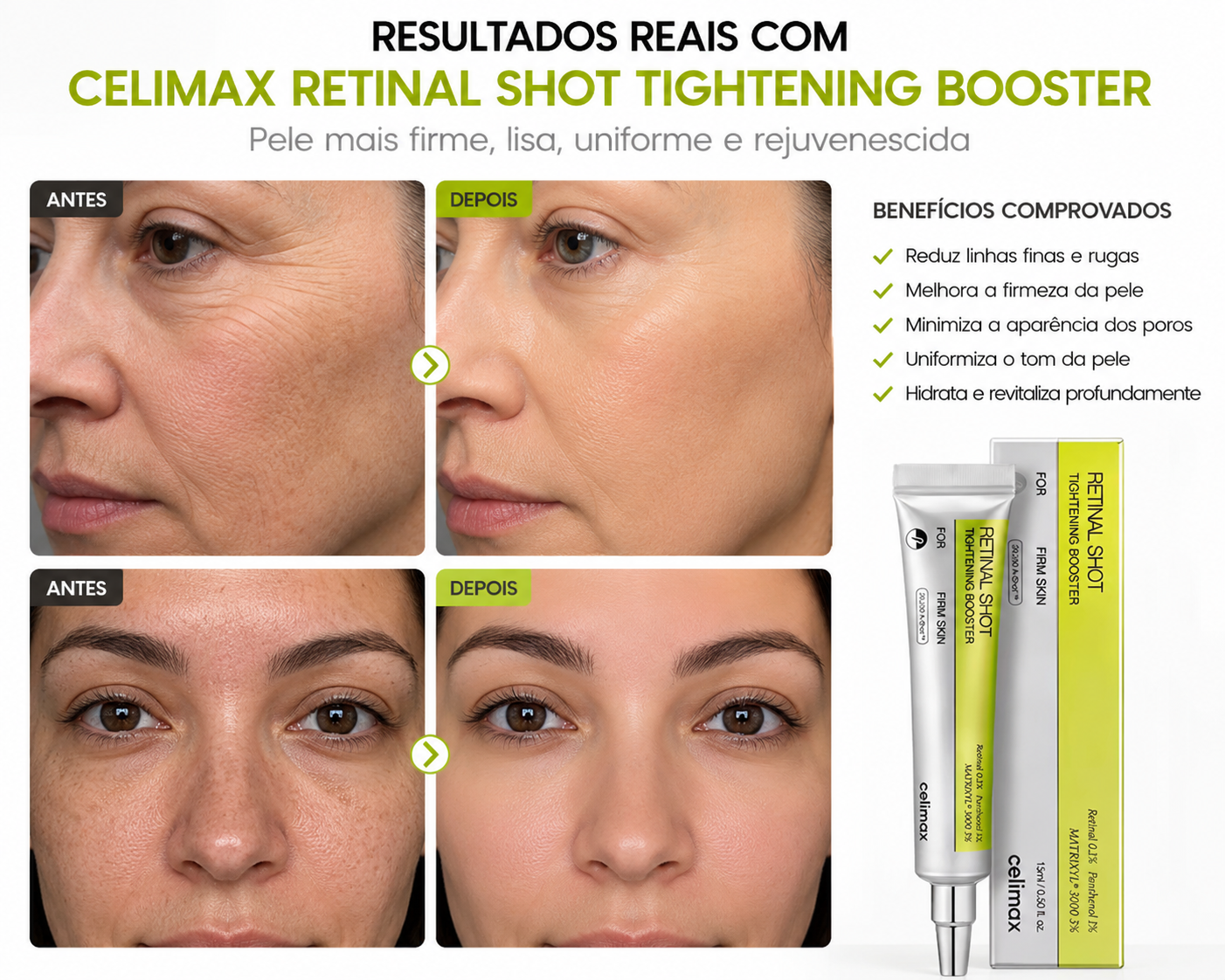 Antes e depois - resultados reais com Celimax Retinal Shot Tightening Booster